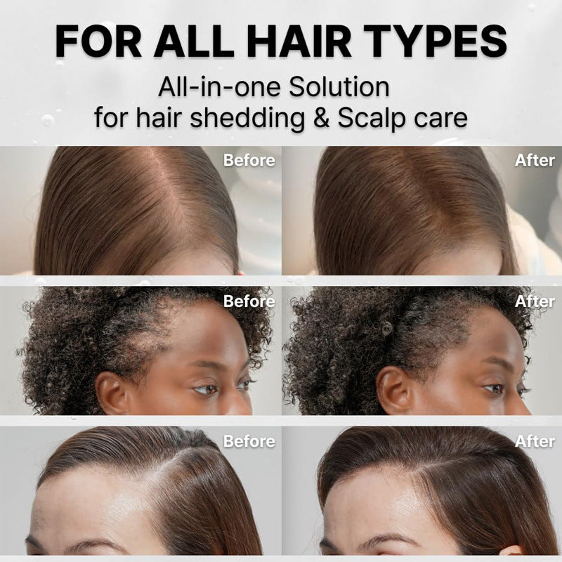 HAIRVANCE™ Scalp Therapy Growth Serum