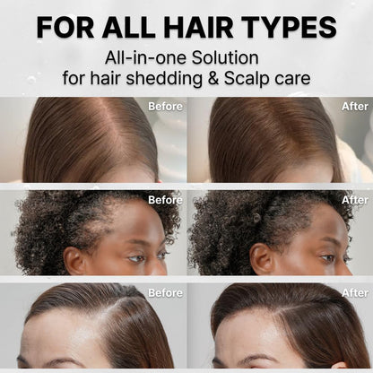 HAIRVANCE™ Scalp Therapy Growth Serum